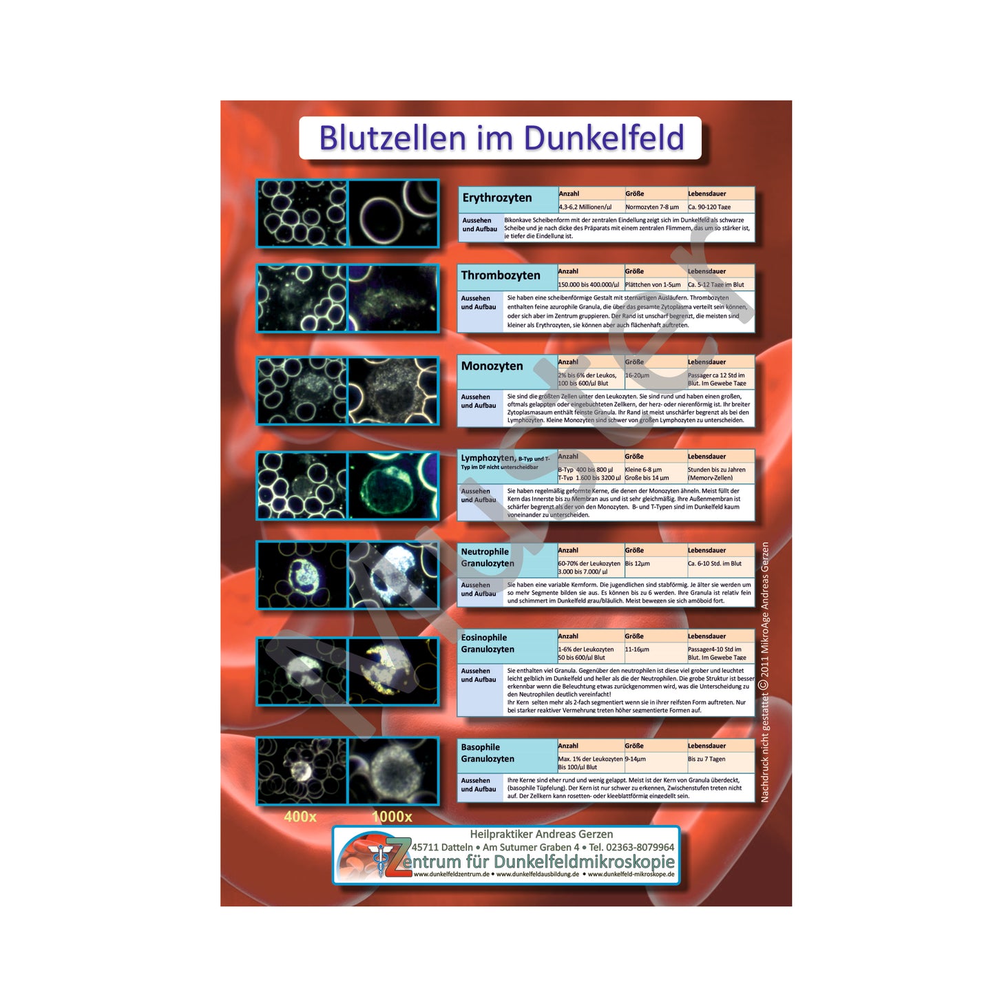 Poster: Blutzellen im Dunkelfeld Größe A4, laminiert