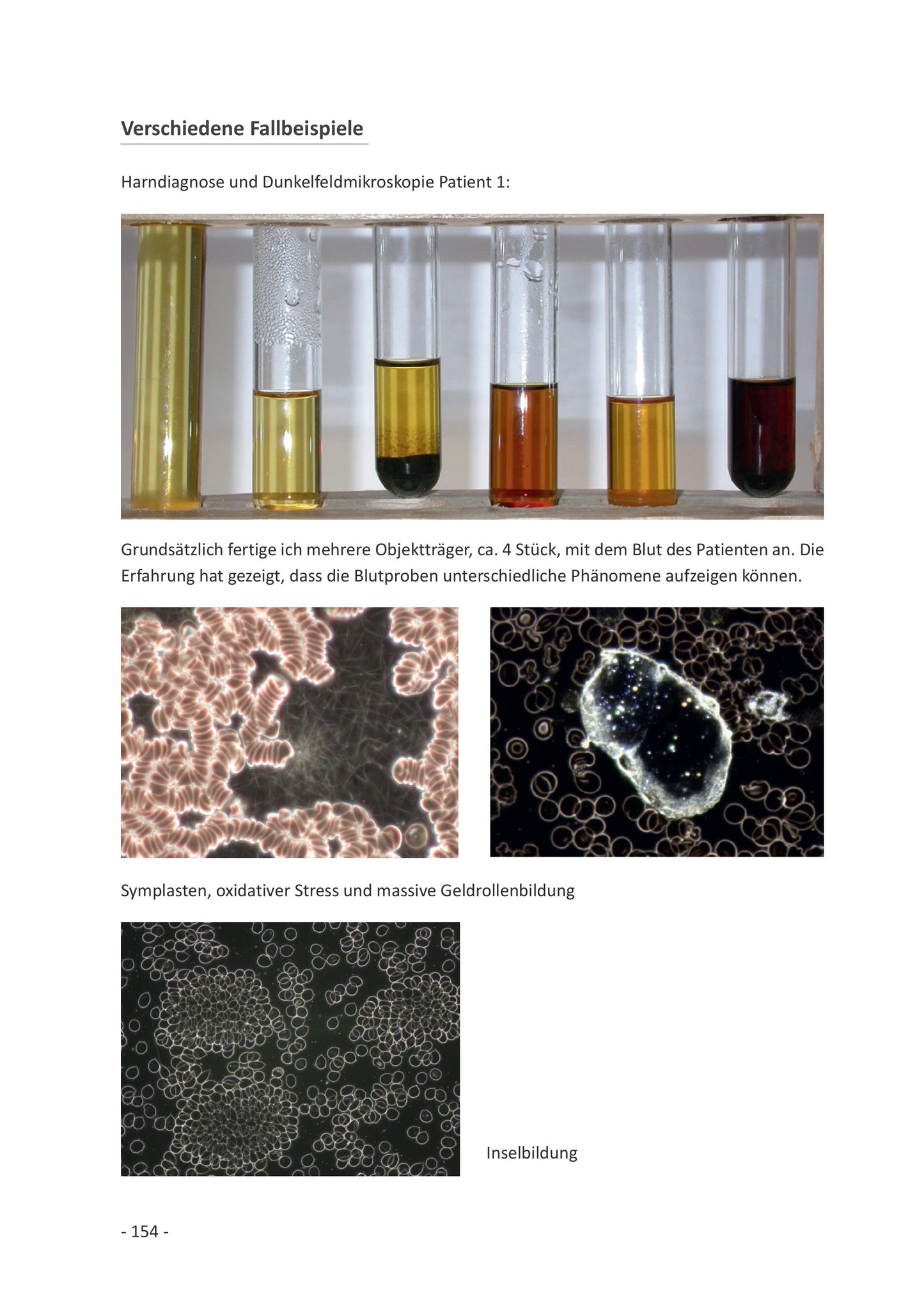 Buch: Harndiagnose und Dunkelfeldmikroskopie im Vergleich